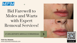 Mole and Wart Removal