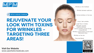 Toxins for Wrinkles in Three Areas 